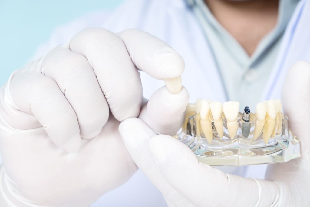 Dentist in white gloves showing model dental implant in clear jaw